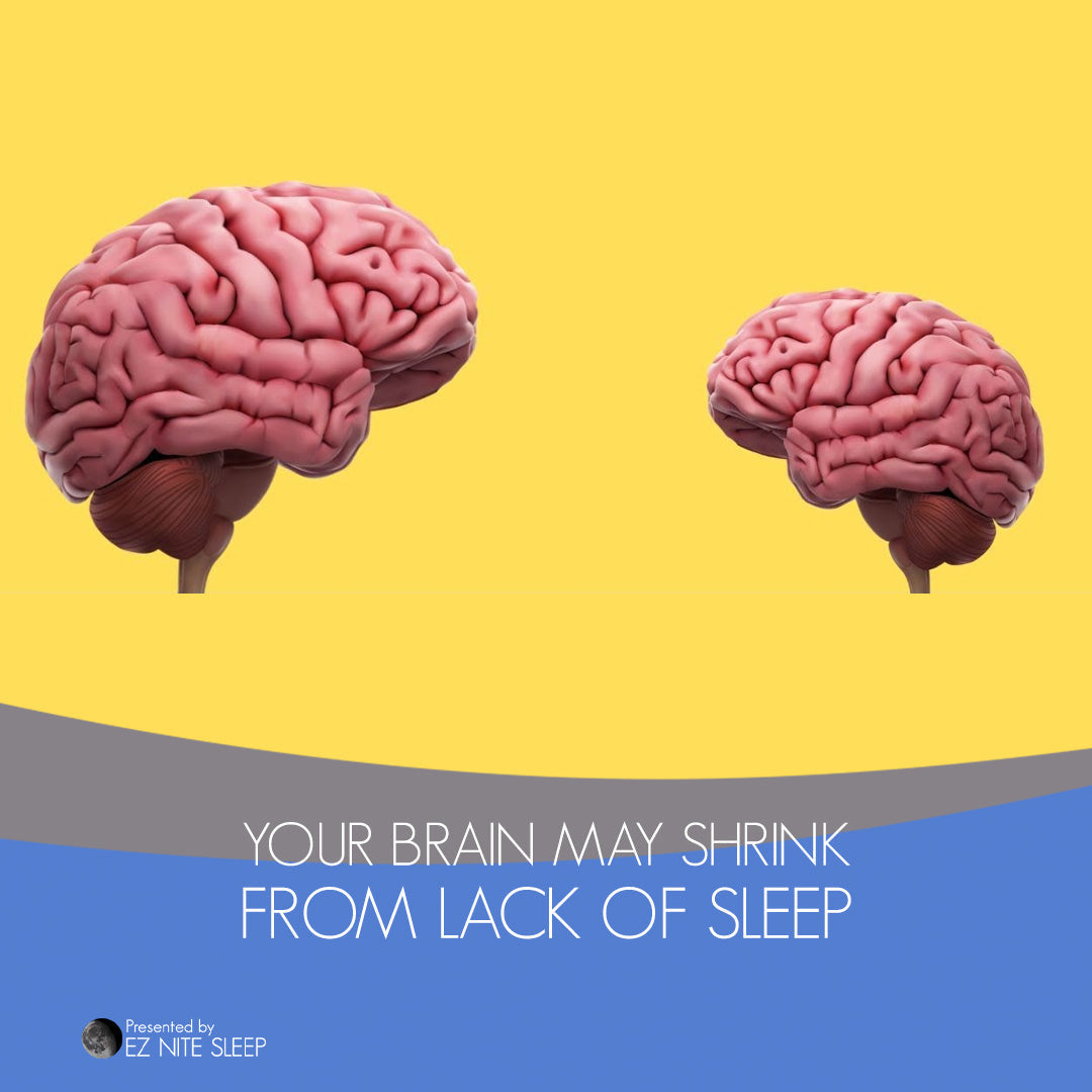 Can Lack of Sleep Shrink Your Brain? What Science Says About Sleep Deprivation and Brain Volume Loss