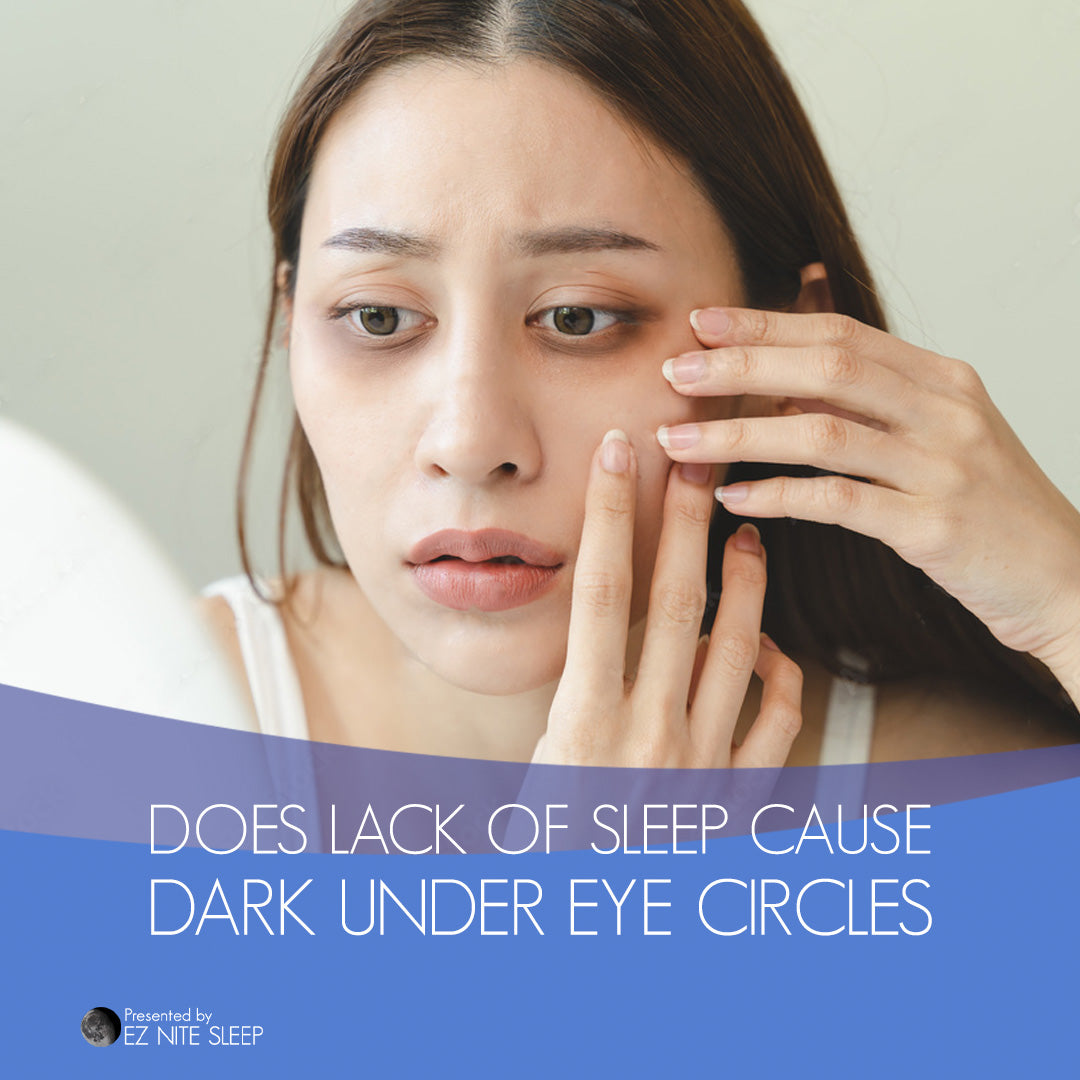 The Truth About Under Eye Dark Circles: Could Lack of Sleep Be to Blame?